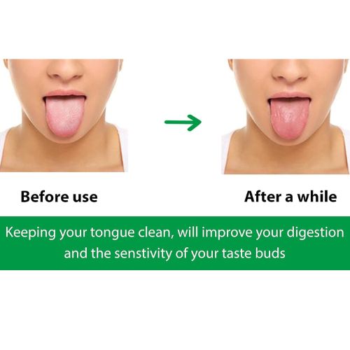 tongue cleaner